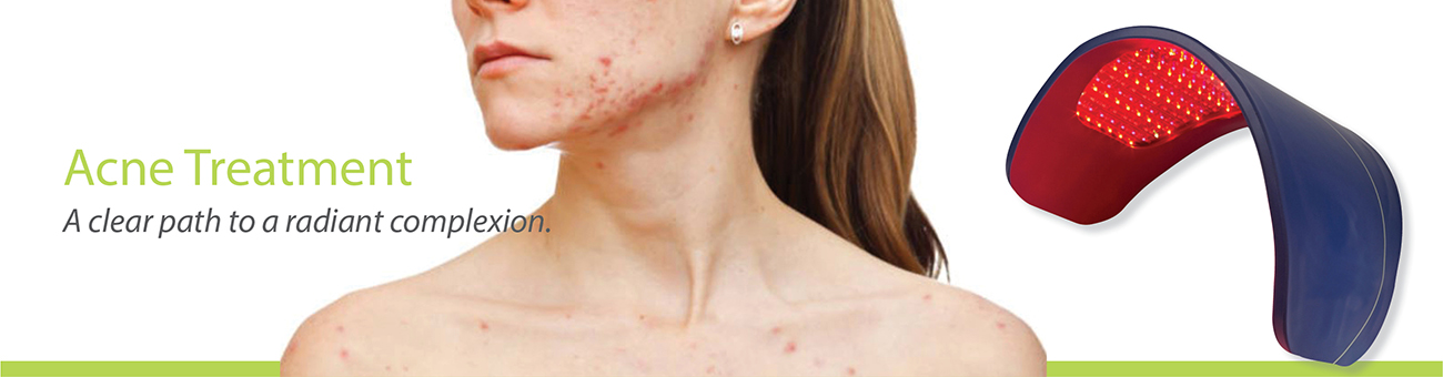 MDL Scientific Web Banner_ACNE TREATMENT 1