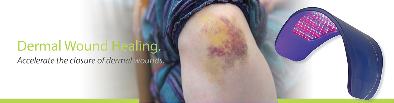 MDL Scientific Web Banner_DERMAL WOUND HEALING 1